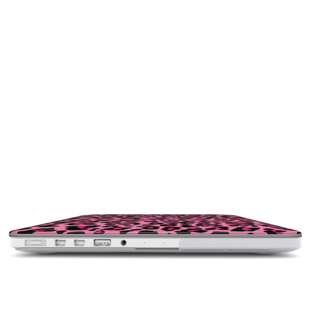 Pink Leopard MacBook Case