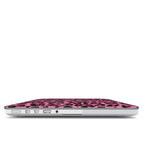 Pink Leopard MacBook Case