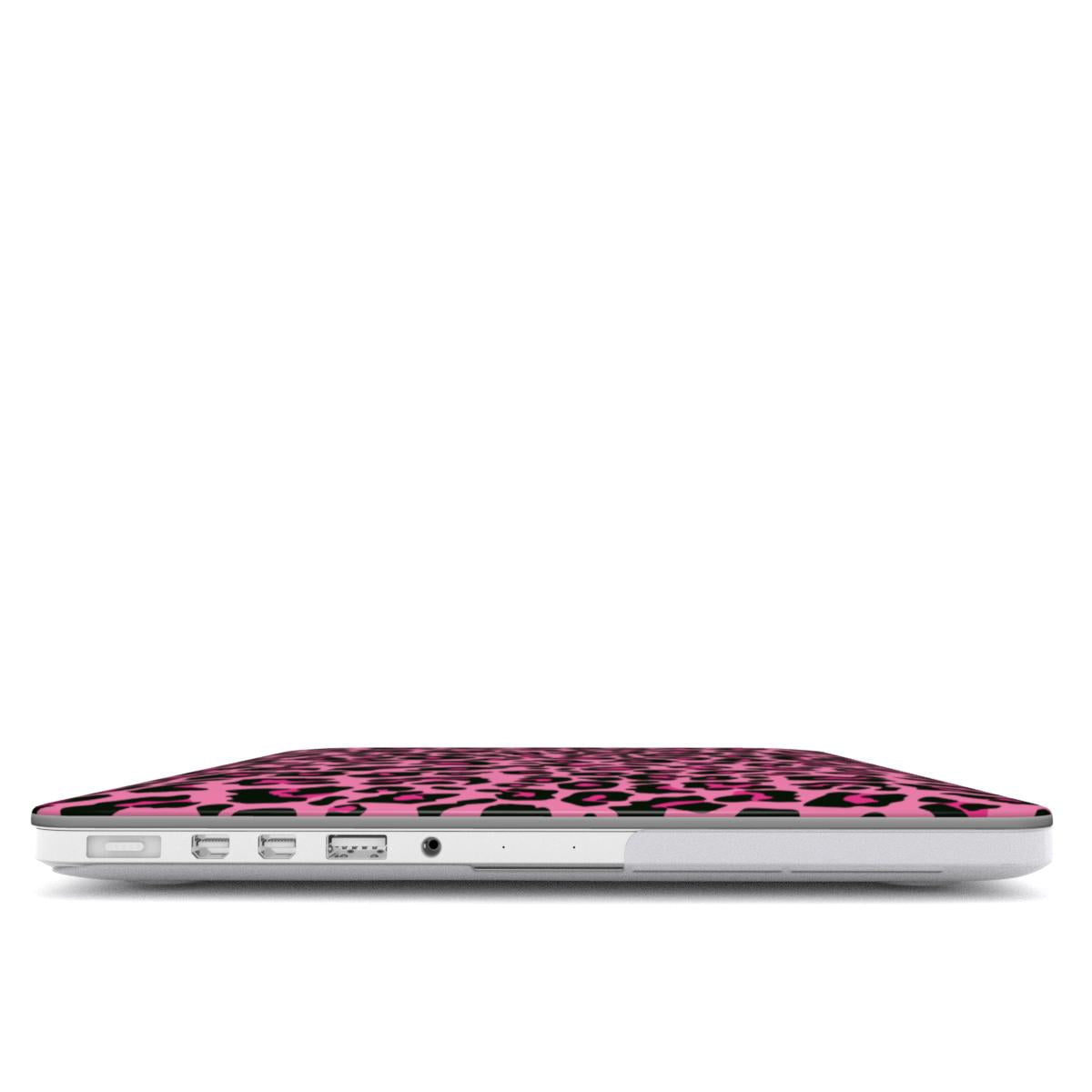 Pink Leopard MacBook Case