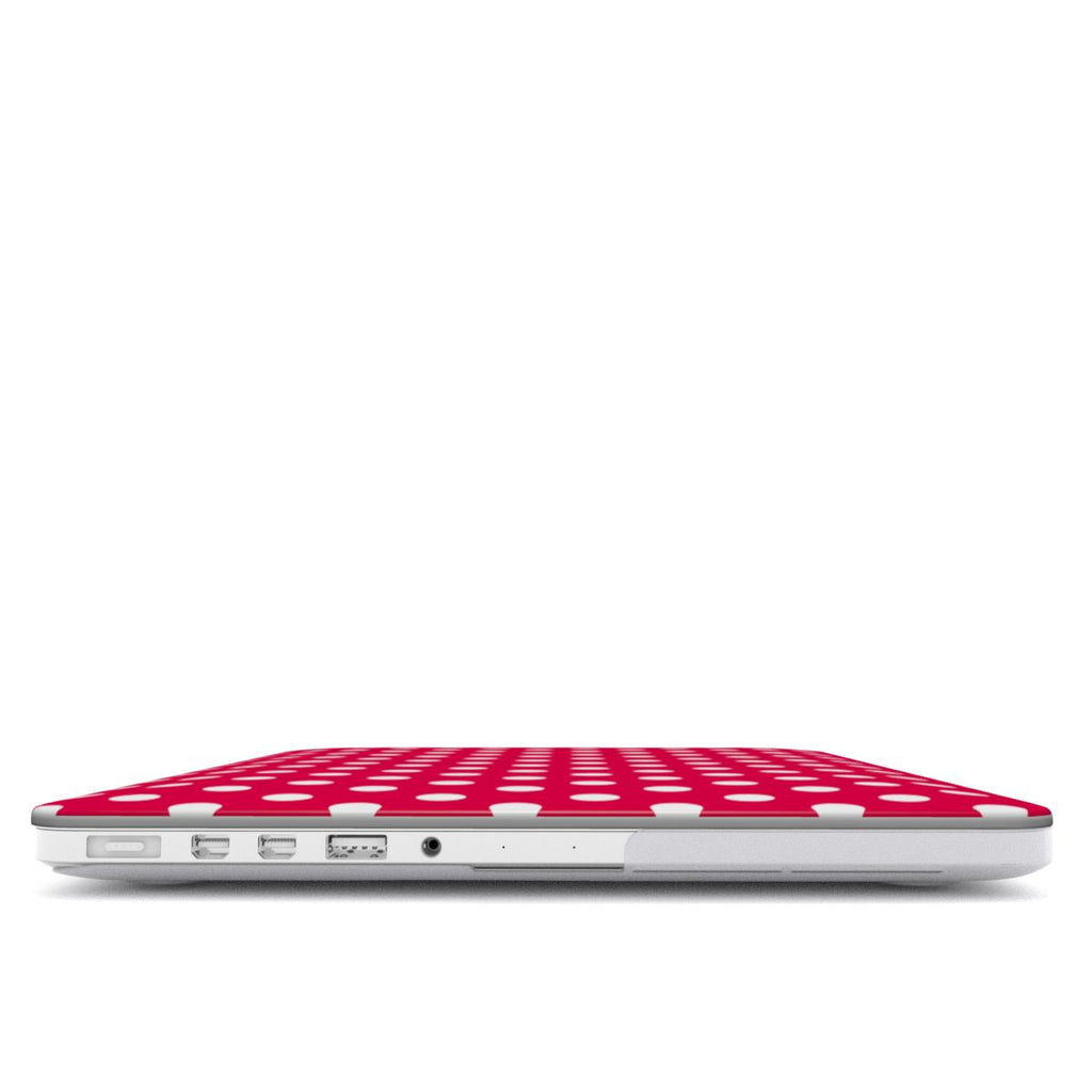 Pink polka dots MacBook Case
