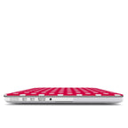 Pink polka dots MacBook Case