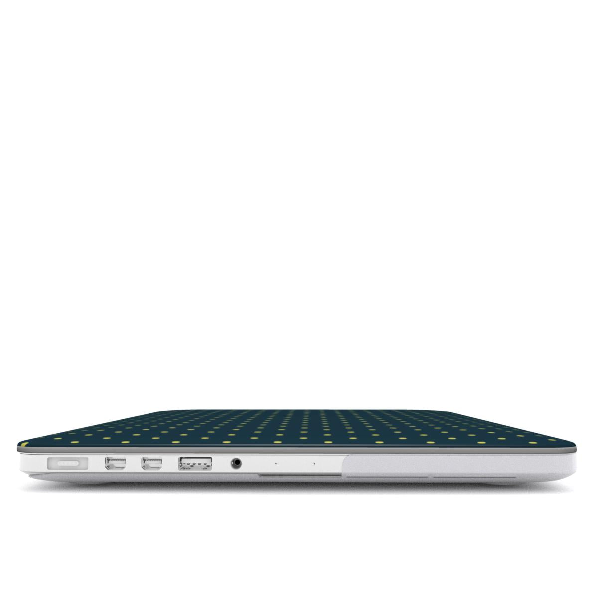 Hiyatt polka dots MacBook Case