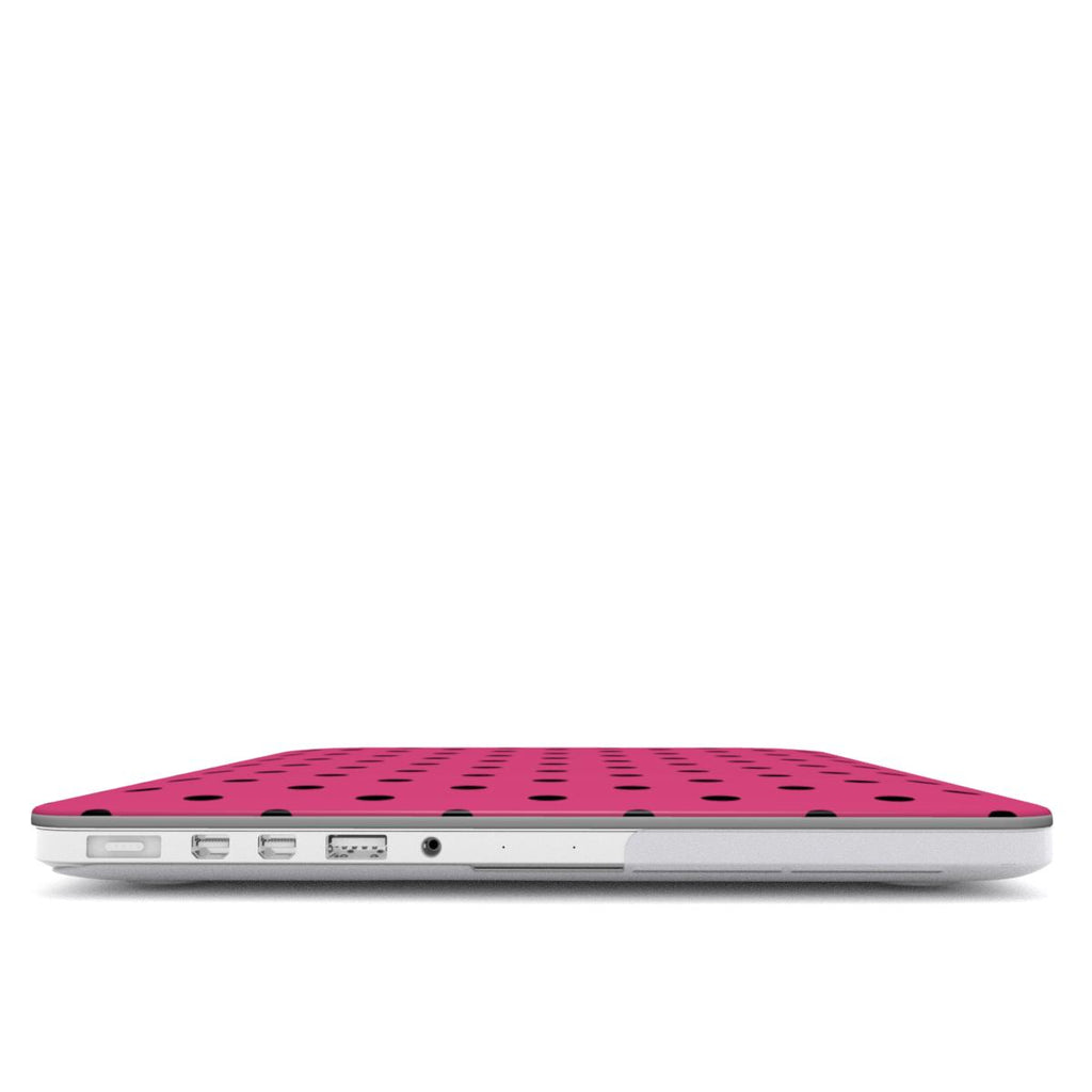 Black Pink Polka Dots MacBook Case