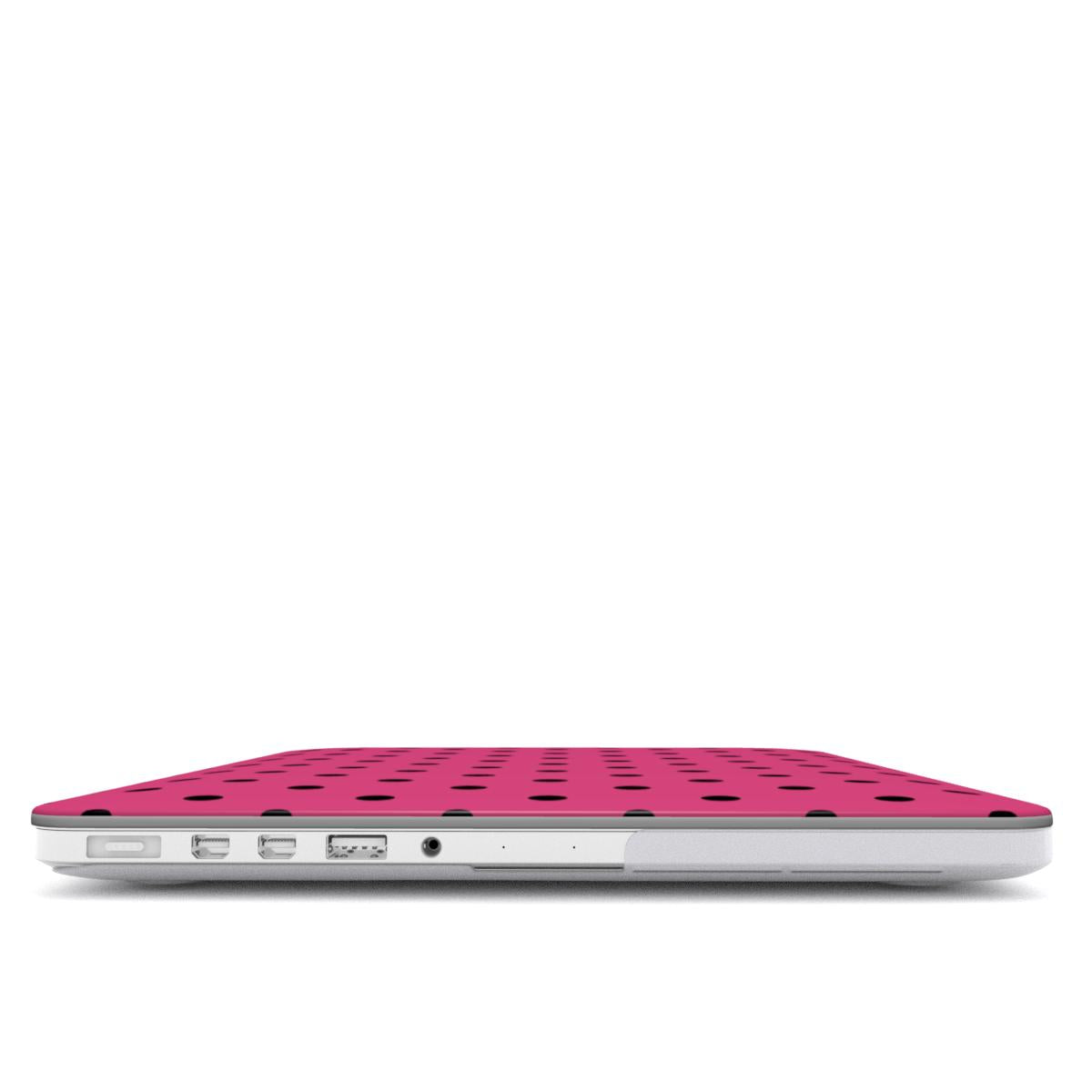 Black Pink Polka Dots MacBook Case