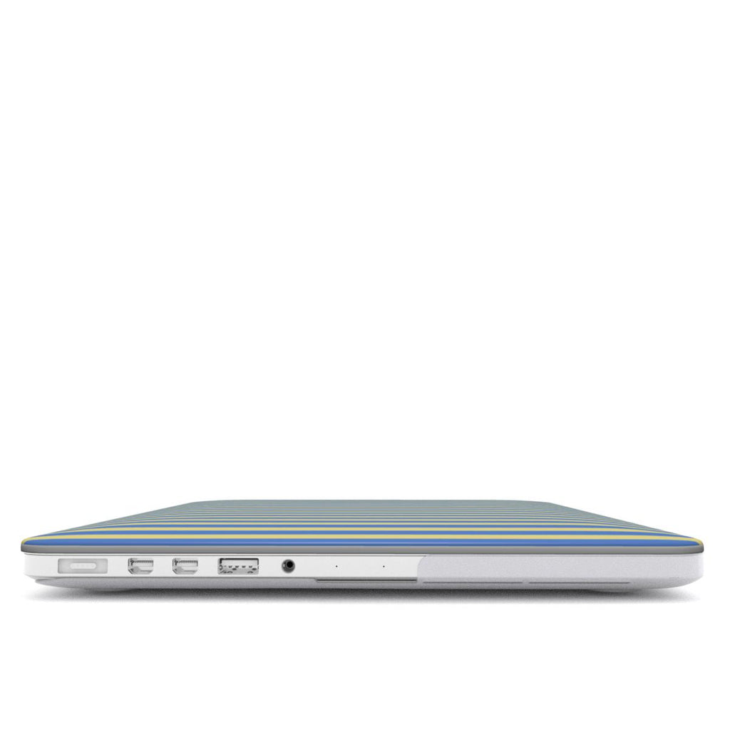 Joke Blue Stripes MacBook Case