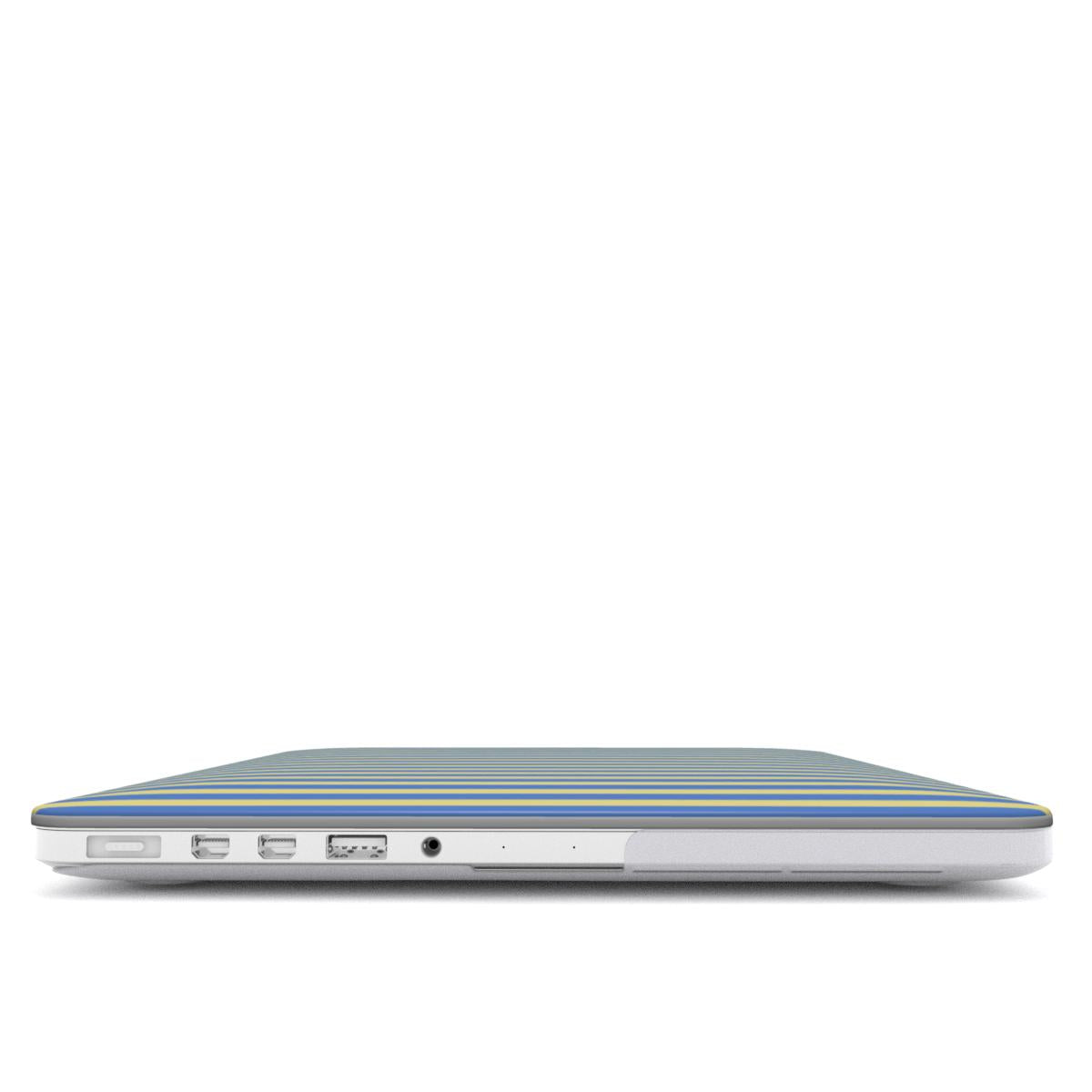 Joke Blue Stripes MacBook Case