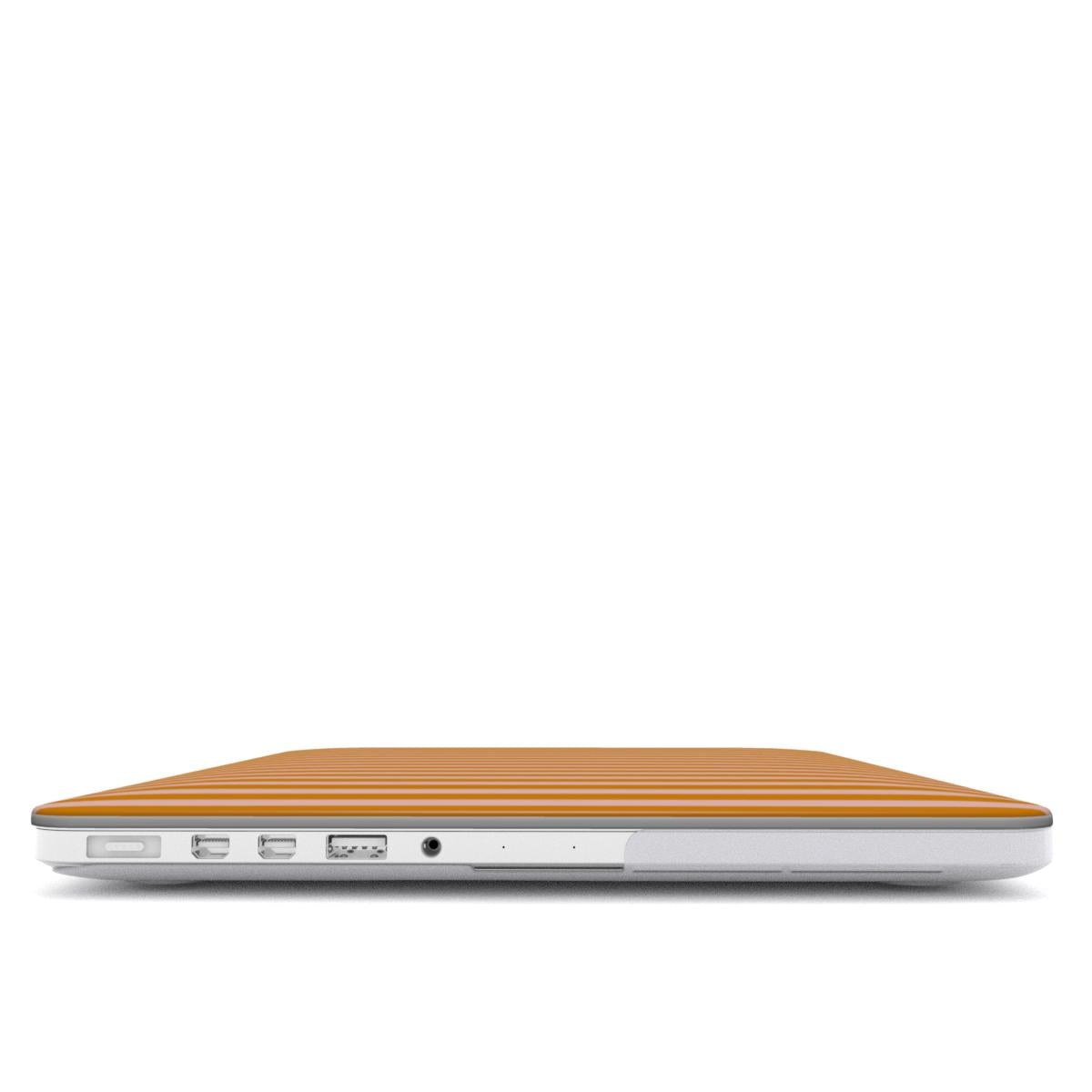 Marlo Yellow Stripes MacBook Case