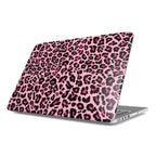 Black Pink Leopard MacBook Case