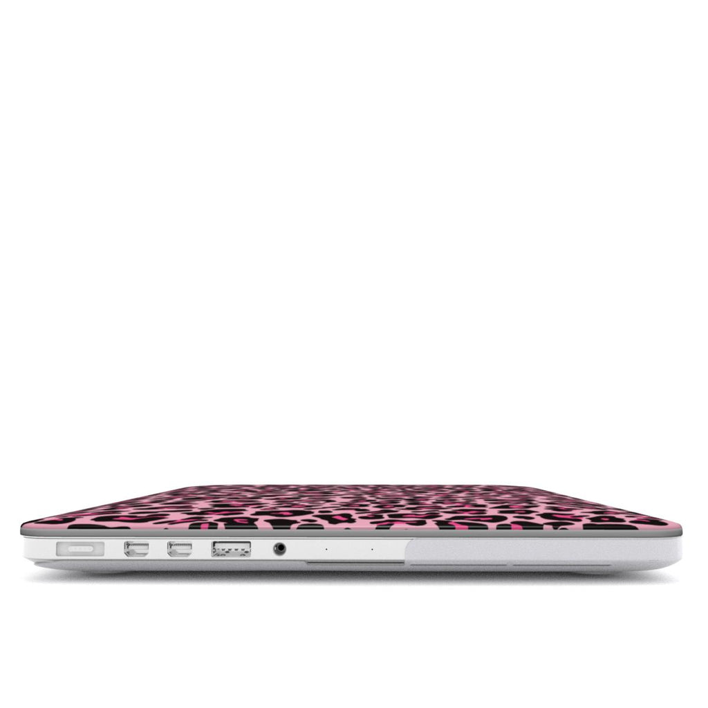 Black Pink Leopard MacBook Case
