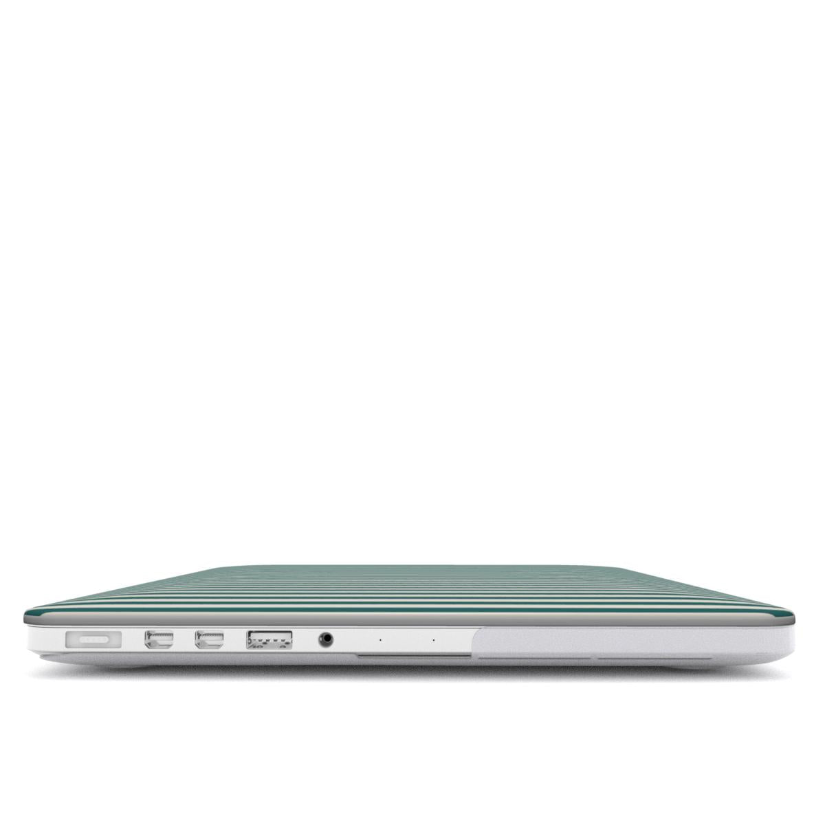 Teel Stripes MacBook Case