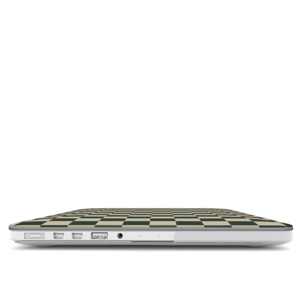 Deep Forest and Sand MacBook Case