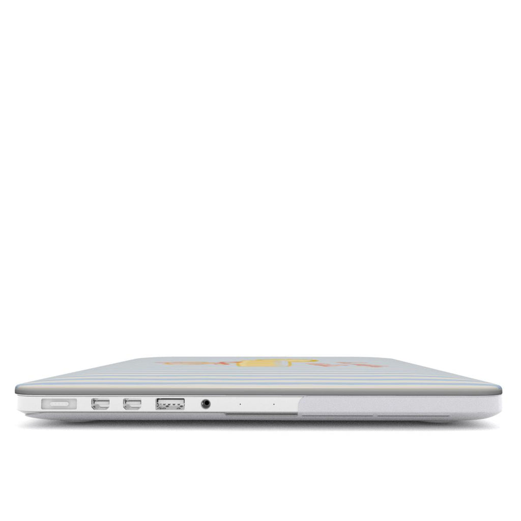 La Dolce Vita | Sky Stripes Coastal MacBook Case