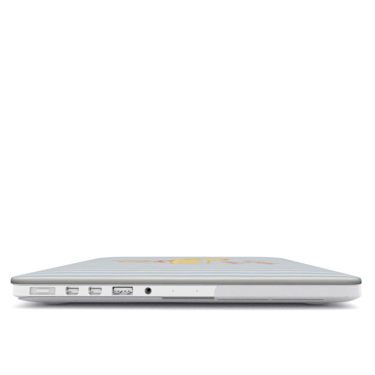 La Dolce Vita | Sky Stripes Coastal MacBook Case