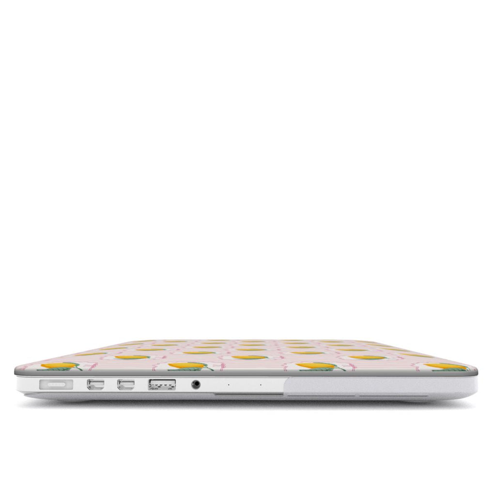 Lemon Coastal MacBook Case