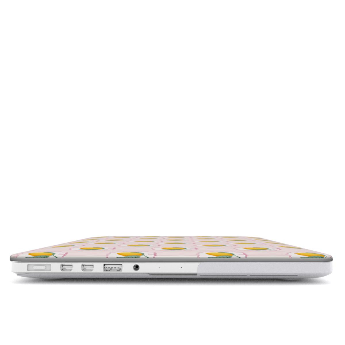 Lemon Coastal MacBook Case